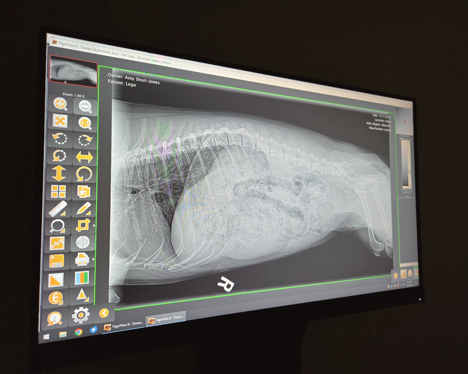 X-ray
